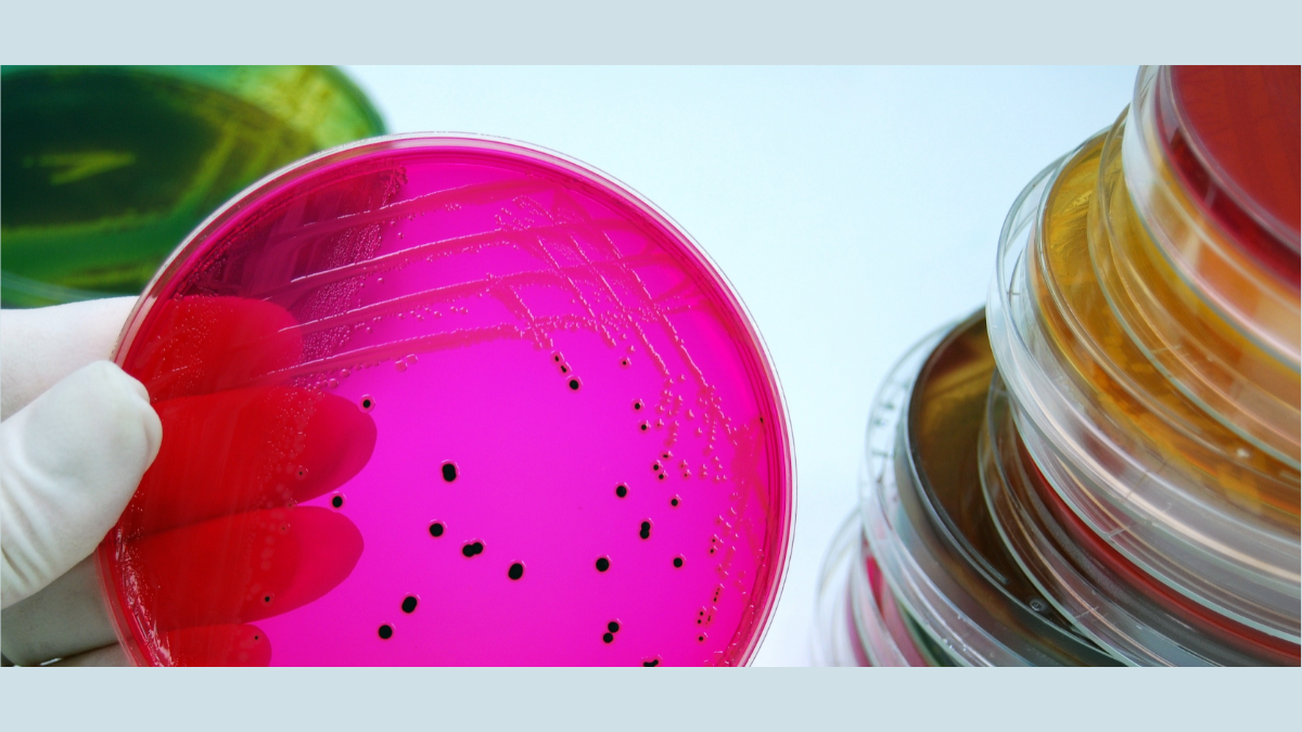 Image of Salmonella on petri dish, Getty Images