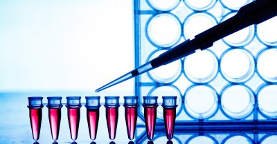 Igenomix PCR test