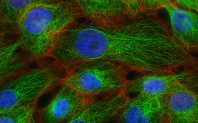 Blue green cancer cells