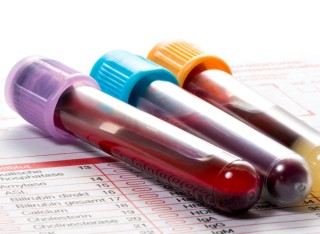 Hospital tubes filled with blood samples