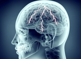 X-ray of human brain