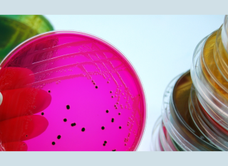 Image of Salmonella on petri dish, Getty Images