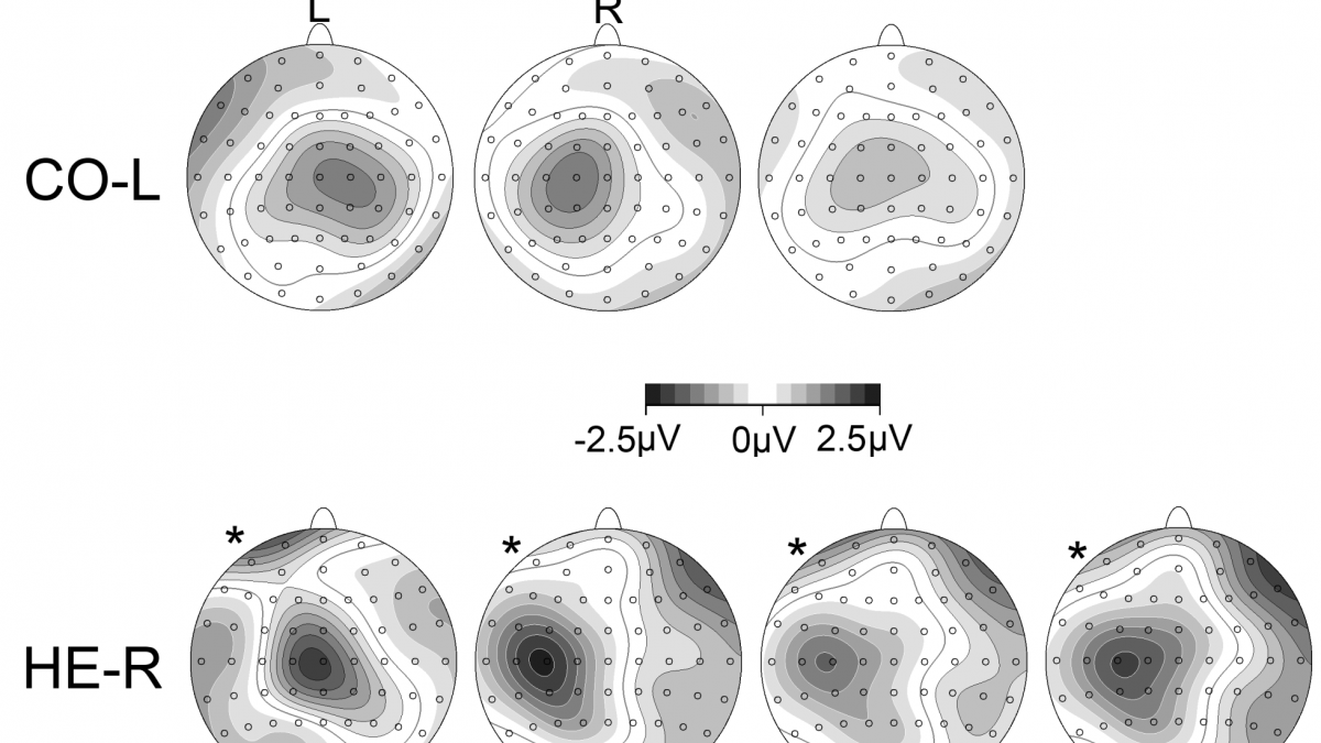 EEG, Hemiparesis & Motor Planning