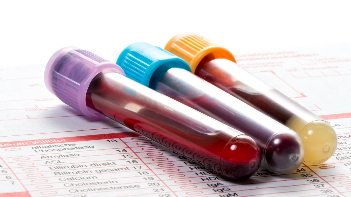 Hospital tubes filled with blood samples