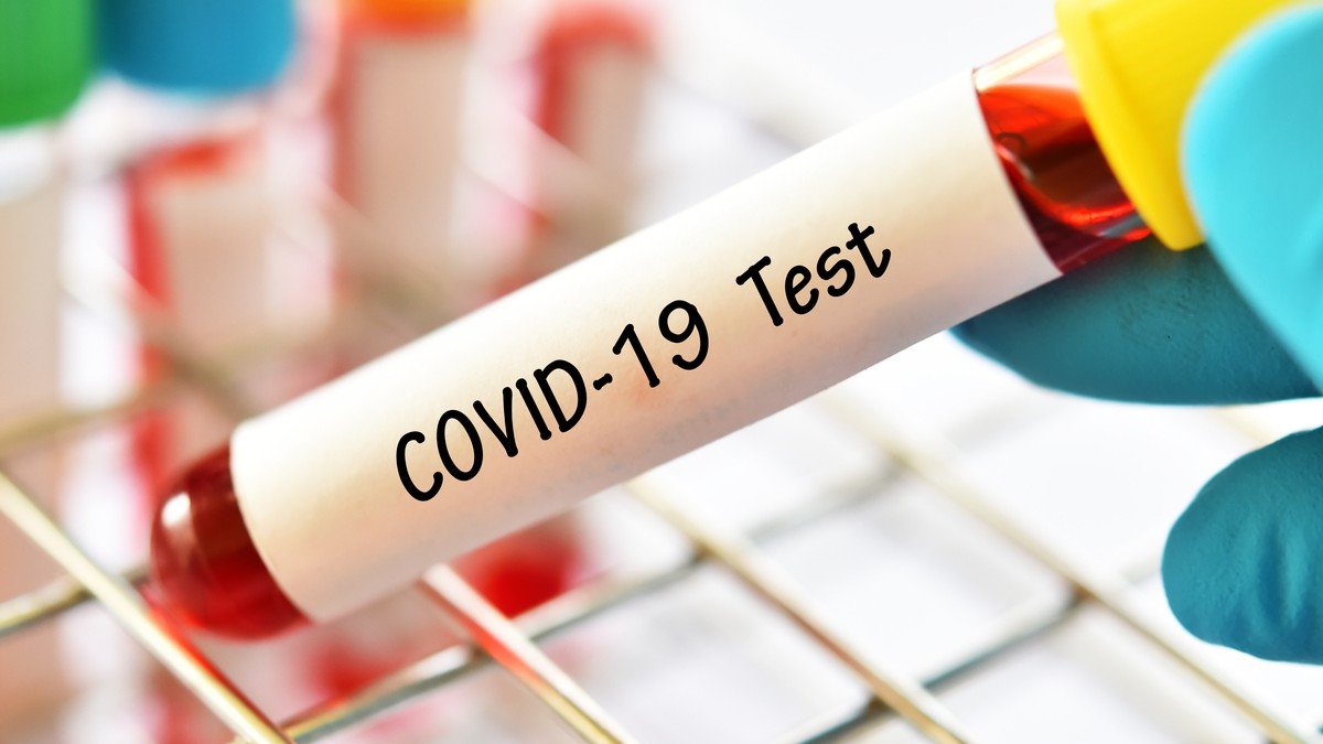 View Covid Test Procedure Uk Pictures