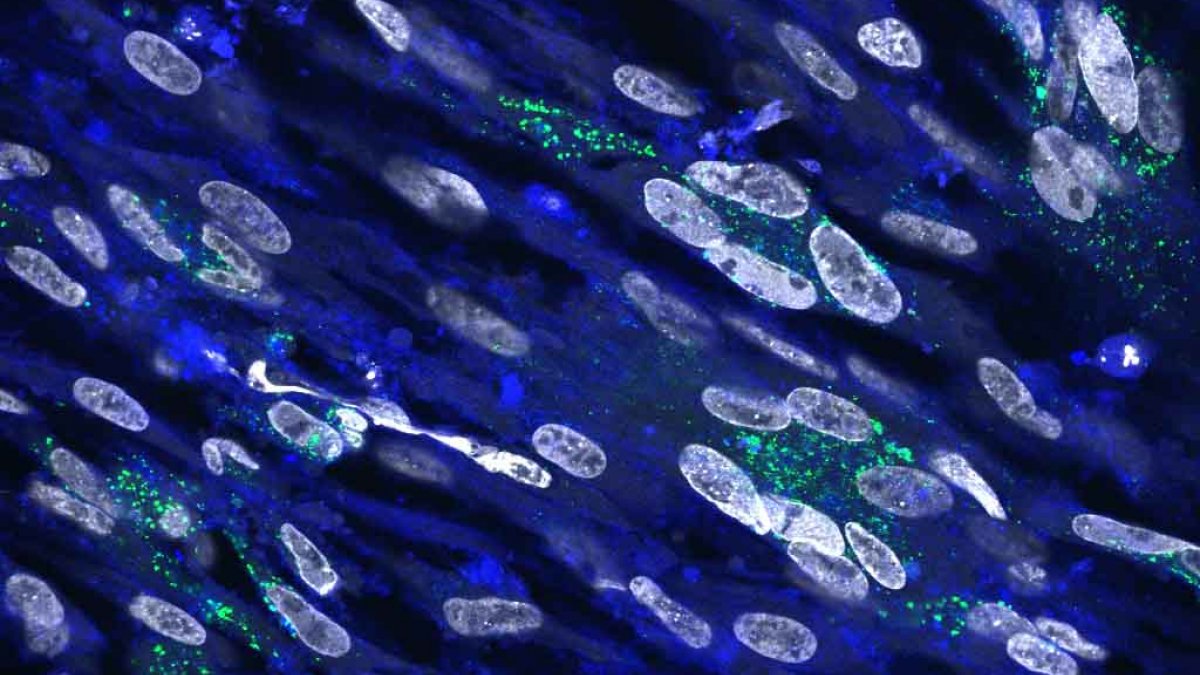 Cholesterol is required for virus replication